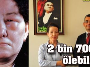Alerjiyle karıştırılan hastalık, 2 bin 700 kişiyi ölümle tehdit ediyor!