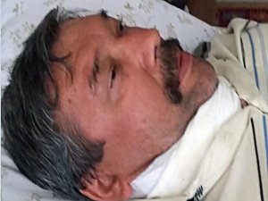 TAKSİCİYE SURİYELİ VAHŞETİ