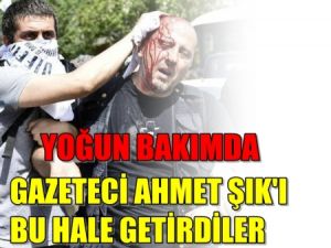 Ahmet Şık'ı Polis Bu hale getirdi