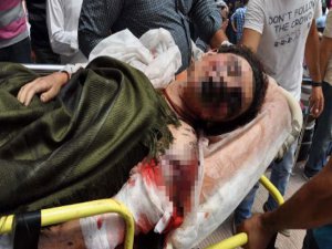 YARALI GENÇ KIZ İÇİN KORKUNÇ ŞÜPHE