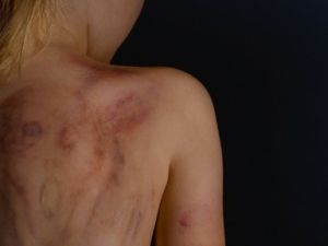 Avrupa’da çocuk pornosuna erişimin yüzde 67′si Türkiye’den