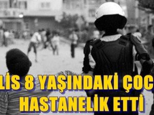 Polis 8 Yaşındaki Çocuğu Hastanelik Etti
