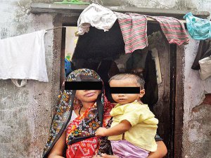 ÜÇ PENİSLE DÜNYAYA GELEN ÇOCUĞA 6 SAATLİK OPERASYON