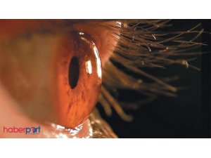 KÖRLÜK TARİH OLUYOR