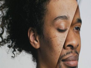 KADINLAR NEDEN ERKEKLERDEN UZUN YAŞAR