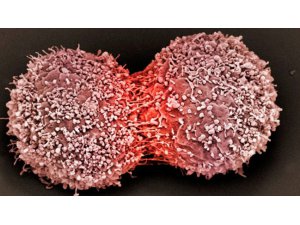 O BİTKİ MEME KANSERİNE UMUT OLDU