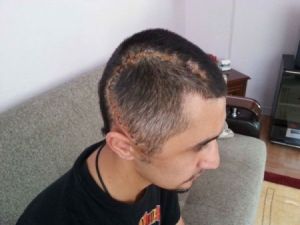 Gezi olaylarında ağır yaralanan genç taburcu oldu.