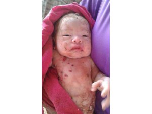 14 YERİNDEN BIÇAKLANIP, ORMANA GÖMÜLEN BEBEK HAYATA TUTUNDU