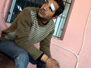 İŞYERİNDE YAKALADIĞI HIRSIZI HASTANELİK ETTİ