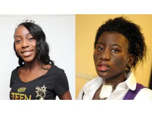 ALLERJİ DEYİP GEÇMEYİN; AFRİKALI GÜZEL BU HALE GELDİ