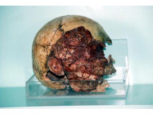 MÜZEDEKİ 7 BİN 200 YILLIK KAFATASINA BÜYÜK İLGİ