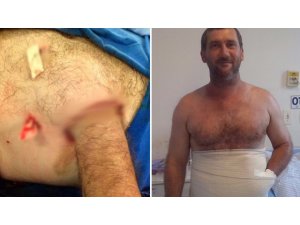 TIP DÜNYASINDA İLGİNÇ OLAY: ELİ KARNINA DİKİLDİ