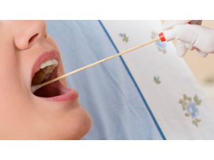 ''YETENEK AVCISI'' GENETİK TEST