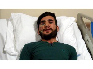 YÜZÜ PARÇALANAN GENCE, BACAĞINDAKİ KEMİK VE DOKUDAN ÇENE YAPILDI