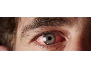 GÖZDEKİ GÖRÜNMEZ TEHLİKEYE DİKKAT