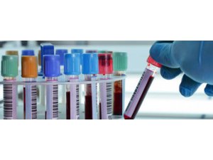 DEPRESYON TEDAVİSİ İÇİN KAN TESTİ