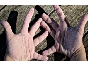 EL VE AYAKLAR NEDEN SUDA BURUŞUR?