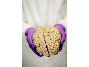 BEYİN PARÇALARINI BAKIN NE YAPIYORLAR?