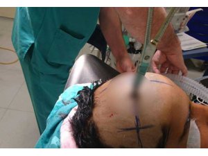 ABİSİNİN ATTIĞI MAKAS BAŞINA SAPLANDI