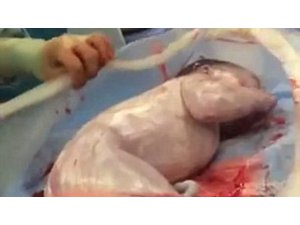 BEBEK ANNE KARNINDAN KENDİ ELLERİYLE ÇIKTI