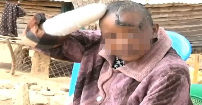 HAMİLE KALAMAYAN KARISININ ELLERİNİ KESTİ