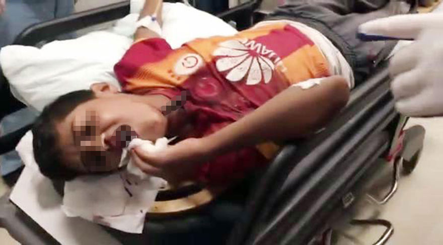 İNŞAATTA KORKUNÇ KAZA: BOĞAZINA DEMİR ÇUBUK SAPLANDI