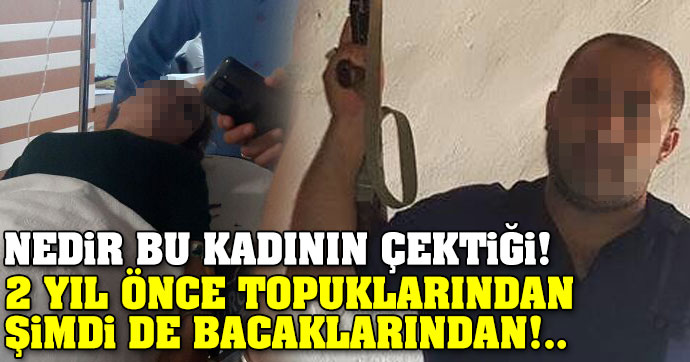 AYRILMAK İSTEYEN EŞİNE KURŞUN YAĞDIRDI