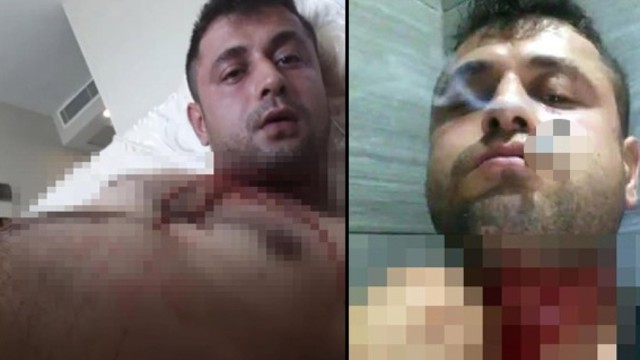 FACEBOOK CANLI YAYINDA JİLETLE BOĞAZINI KESTİ