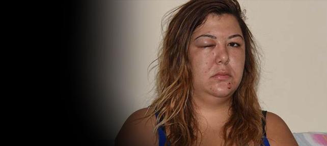 GENÇ ÖĞRETMENİ "HAYIR" DEDİ DİYE DARP ETTİLER