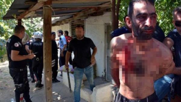 ÖNCE POLİSİ SONRA KENDİNİ KESTİ