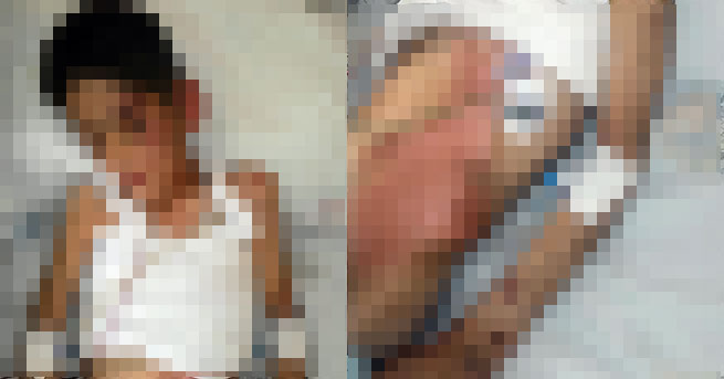 ANKARA'DA ÖZ ANNE VAHŞETİ ÇOCUĞU  BU HALE GETİRDİ