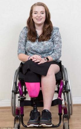 TIRNAK BATMASINA DAYANAMDI, BACAĞINI KESTİRDİ