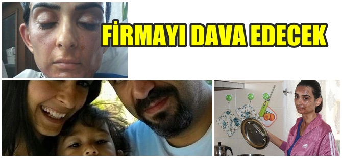 İZMİR'DE DÜDÜKLÜ TENCERE DEHŞETİ; EV KADINI YANDI