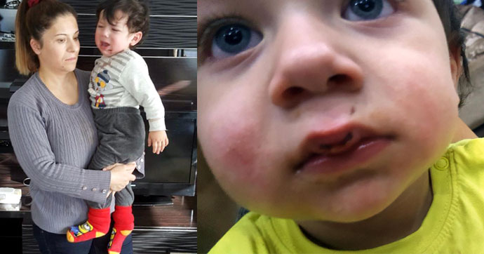 ANTALYA'DA TRAFİKTE DEHŞET ARDINDAN SKANDAL