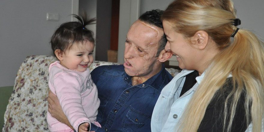 YÜZ NAKİLLİ RECEP SERT'E KÖTÜ HABER