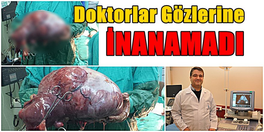 KONYALI HASTANIN KARNINDAN BU ÇIKTI ; 40 CM