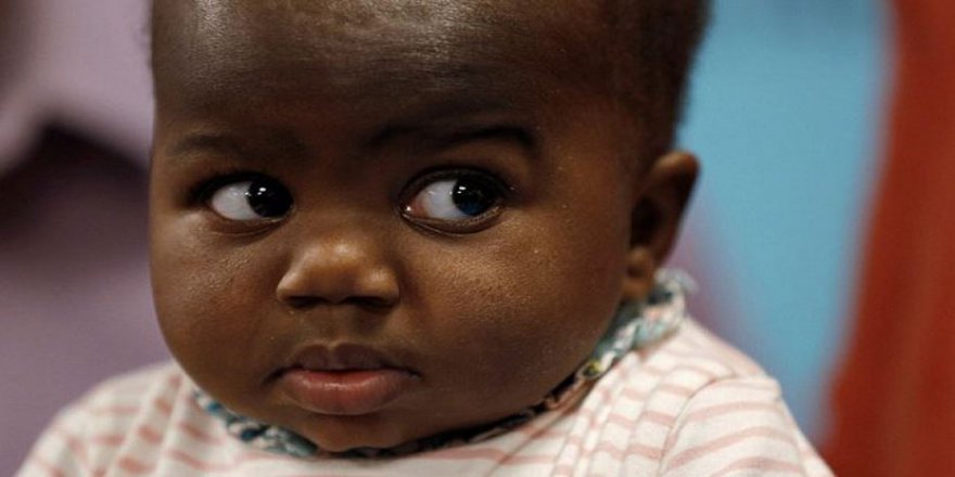 4 ayaklı ve 2 omurgalı doğdu