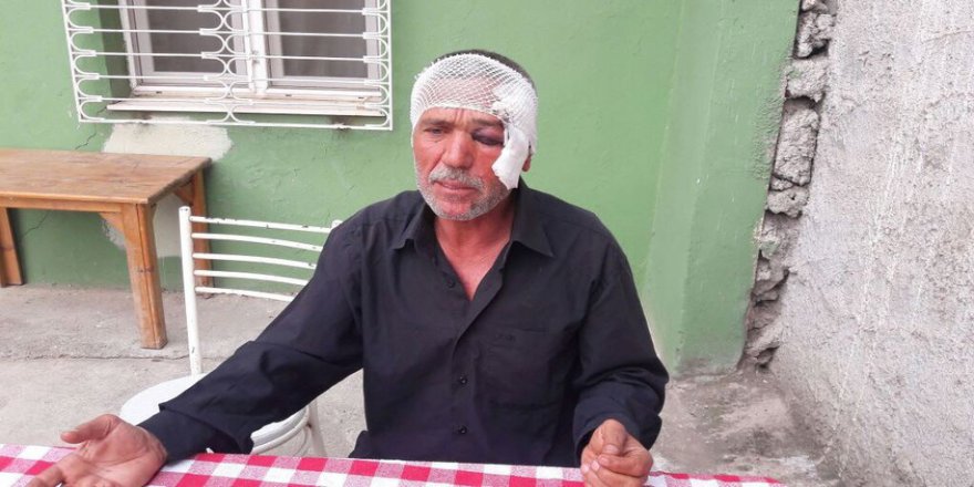 Adana'da 'Hayır' dayağı iddiası