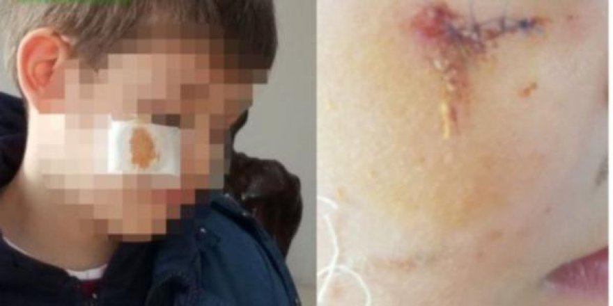Esenler'de illkokulda öğrenciye darp iddiası