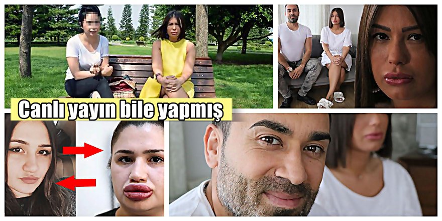 Estetik dudak dolgusu skandalında flaş gelişme