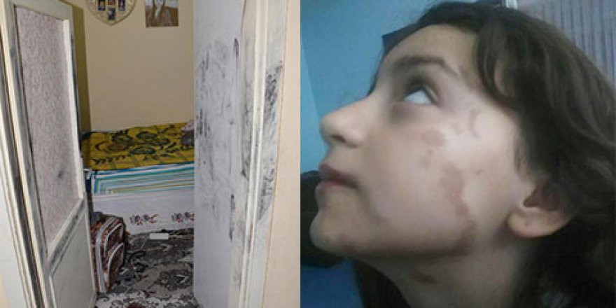 Uyuyan hala ve yeğenin üzerine asit döktüler