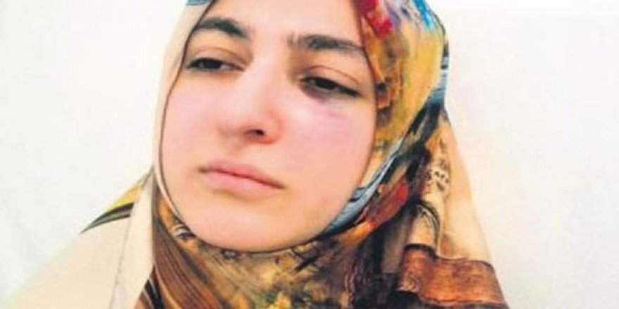 'Dişimi acıttın' dedi, diş hekimini yumrukladı