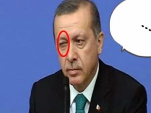 ERDOĞAN KİME GÖZ KIRPTI