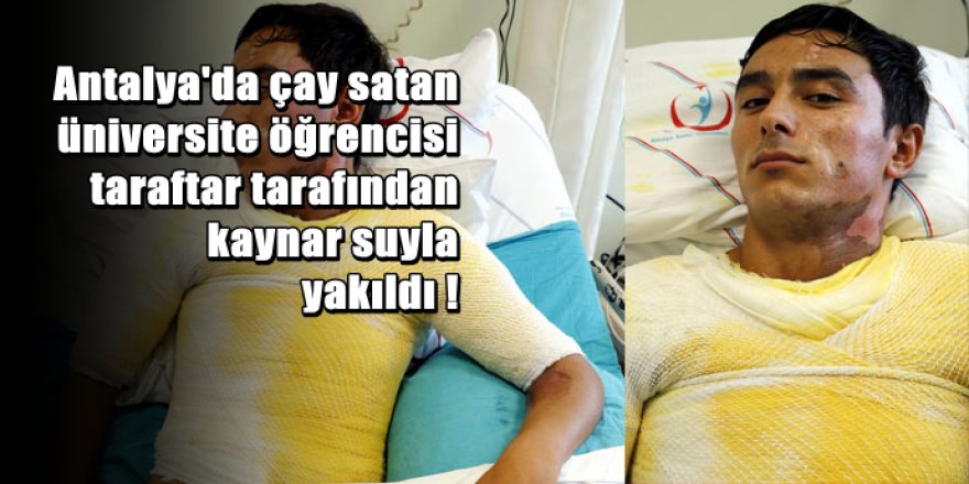 Çay kazanını kafasından aşağı döktüler