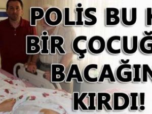 Polis bu kez bir çocuğun bacağını kırdı