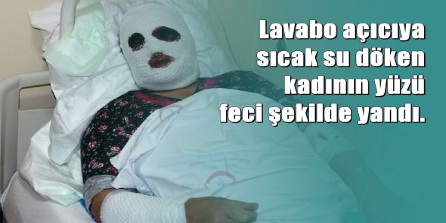 Temizlik yaparken bu hale geldi