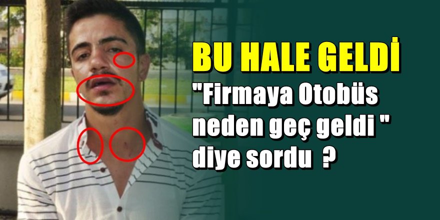 Antalya'da Metro Turizm'de bir olay daha