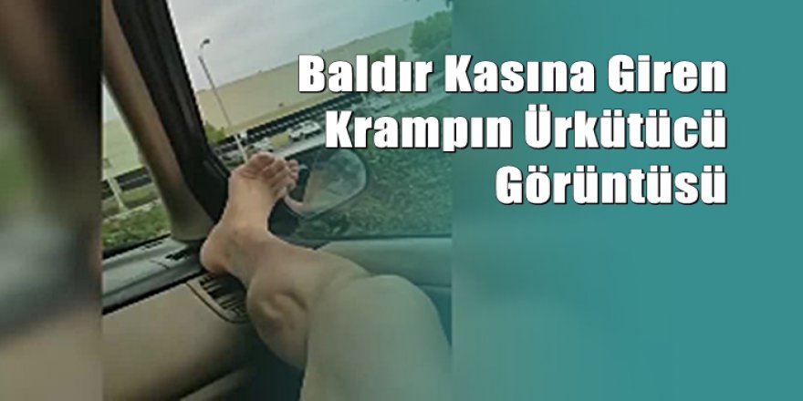 Baldır Kasına Giren Krampın Ürkütücü Görüntüsü