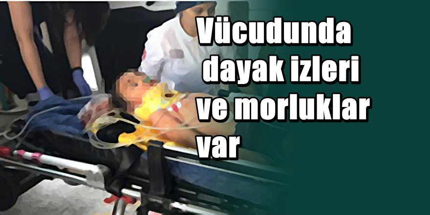 Kocaeli'nde 5 Yaşında çocuğun boğazını kestiler