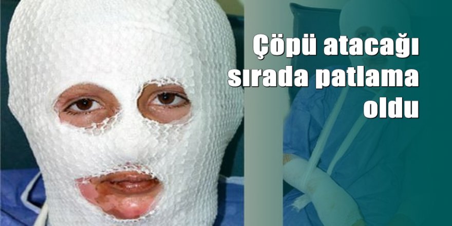 Patlayan parfüm şişesi hayatını kararttı